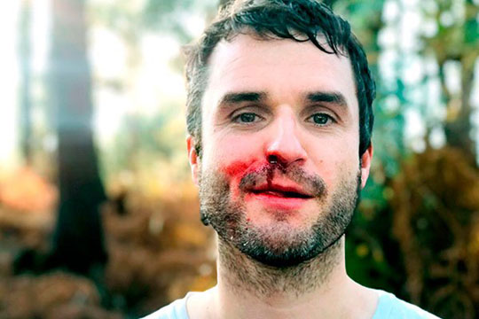 Moxal, Miren Narbaiza eta Inner